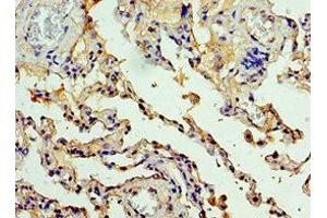 Immunohistochemistry of paraffin-embedded human lung tissue using ABIN7146811 at dilution of 1:100 (CEACAM8 抗体  (AA 35-320))
