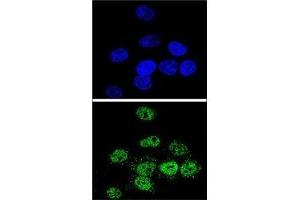 Confocal immunofluorescent analysis of MEF2A antibody with HeLa cells followed by Alexa Fluor 488-conjugated goat anti-rabbit lgG (green). (MEF2A 抗体  (AA 453-479))