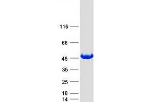 Western Blotting (WB) image for GDP-Mannose Pyrophosphorylase A (GMPPA) (Transcript Variant 2) protein (Myc-DYKDDDDK Tag) (ABIN2721784)