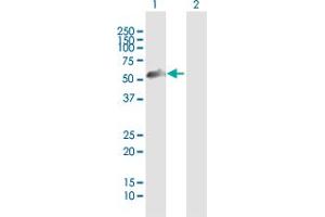 Western Blot analysis of ZNF232 expression in transfected 293T cell line by ZNF232 MaxPab polyclonal antibody. (ZNF232 抗体  (AA 1-444))