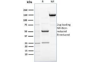 SDS-PAGE Analysis Purified RCAS1 Mouse Monoclonal Antibody (CPTC-EBAG9-1). (RCAS1 抗体)