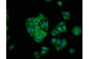 Immunofluorescence staining of HepG2 cells with ABIN7157616 at 1:133, counter-stained with DAPI. (KIF2B 抗体  (AA 1607-1731))