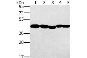 Western Blot analysis of Hela, skov3 and A549 cell, Mouse liver and Human ovarian cancer tissue using PON1 Polyclonal Antibody at dilution of 1:500 (PON1 抗体)