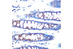 Immunohistochemistry of paraffin-embedded human colon using BMP4 Rabbit mAb (ABIN7265898) at dilution of 1:100 (40x lens). (BMP4 抗体)