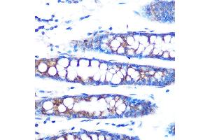 Immunohistochemistry of paraffin-embedded human colon using BMP4 Rabbit mAb (ABIN7265898) at dilution of 1:100 (40x lens). (BMP4 抗体)