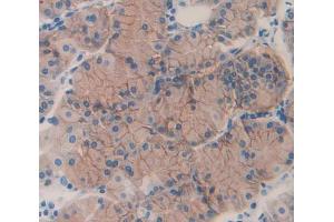 IHC-P analysis of Human Tissue, with DAB staining. (ERN1 抗体  (AA 571-832))