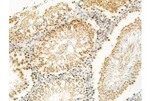 Phospho-Ki67 (Thr1335) Antibody at 1/100 staining Rat testis tissue by IHC-P. (Ki-67 抗体  (pThr1335))