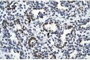 Rabbit Anti-RBM10 Antibody Catalog Number: ARP30103 Paraffin Embedded Tissue: Human Lung Cellular Data: Alveolar cells Antibody Concentration: 4. (RBM10 抗体  (N-Term))