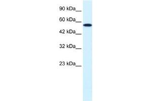 WB Suggested Anti-CHEK1 Antibody Titration:  0. (CHEK1 抗体  (Middle Region))