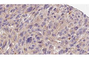 Immunohistochemistry (IHC) image for anti-Collagen, Type IV, alpha 6 (COL4a6) (Internal Region) antibody (ABIN6260932)