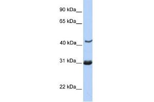 NUP35 antibody used at 1 ug/ml to detect target protein. (NUP35 抗体  (C-Term))