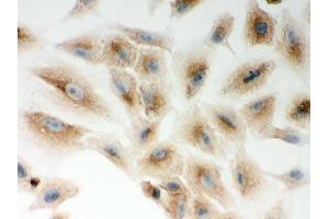 Immunohistochemistry (IHC) image for anti-Nucleotide-Binding Oligomerization Domain Containing 1 (NOD1) (AA 1-160) antibody (ABIN3043890)