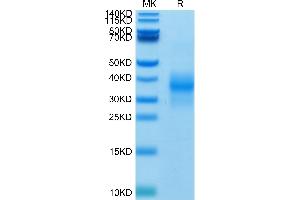 SDS-PAGE (SDS) image for Killer Cell Lectin-Like Receptor Subfamily K, Member 1 (KLRK1) (AA 78-216) protein (His-Avi Tag,Biotin) (ABIN7275343)