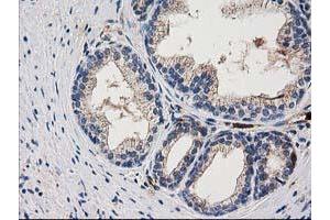 Image no. 3 for anti-ADP-Ribosylation Factor GTPase Activating Protein 1 (ARFGAP1) antibody (ABIN1496679)