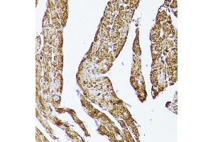 Immunohistochemistry (IHC) image for anti-Voltage-Dependent Anion Channel 2 (VDAC2) (AA 1-100) antibody (ABIN7271337)