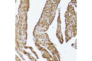 Immunohistochemistry of paraffin-embedded rat heart using VD Rabbit pAb (ABIN7271337) at dilution of 1:150 (40x lens). (VDAC2 抗体  (AA 1-100))
