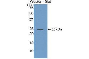 Western Blotting (WB) image for anti-Sex Hormone Binding Globulin (SHBG) (AA 224-388) antibody (ABIN1172834) (SHBG 抗体  (AA 224-388))