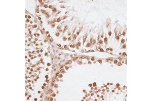 Immunohistochemistry of paraffin-embedded rat testis using Histone H2AX antibody (ABIN7267725) at dilution of 1:100 (40x lens). (Histone H2A 抗体  (C-Term))