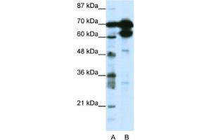 Western Blotting (WB) image for anti-Zinc Finger Protein 76 (Expressed in Testis) (ZNF76) antibody (ABIN2461696) (ZNF76 抗体)