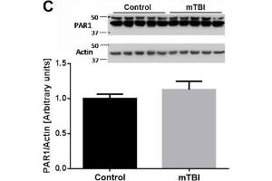 At two weeks upon injury, brain thrombin activity and concentration are similar between mTBI exposed animals and controls. (PAR1 抗体  (AA 251-350))