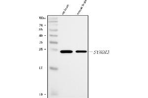 Western blot analysis of Synaptogyrin 3/SYNGR3 using anti-Synaptogyrin 3/SYNGR3 antibody (ABIN7601760). (Synaptogyrin 3 抗体  (AA 45-229))