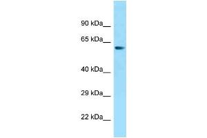 WB Suggested Anti-ZNF238 Antibody Titration: 1. (ZNF238 抗体  (N-Term))