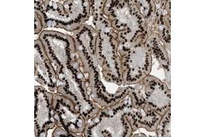 Immunohistochemical staining of human duodenum with ZFR polyclonal antibody  shows strong nuclear and membranous positivity in glandular cells at 1:10-1:20 dilution. (ZFR 抗体)
