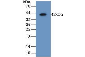 Figure. (AIMP1 抗体  (AA 2-310))