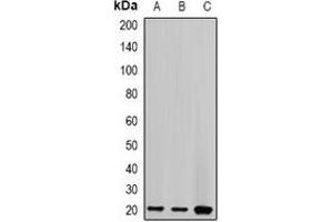 Western blot analysis of Centrin-2 expression in HT29 (A), MCF7 (B), mouse spleen (C) whole cell lysates.