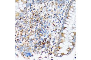 Immunohistochemistry of paraffin-embedded human appendix using CDC25B Rabbit mAb (ABIN7266250) at dilution of 1:100 (40x lens). (CDC25B 抗体)