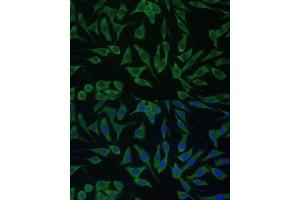 Immunofluorescence analysis of L929 cells using DDX3Y Polyclonal Antibody (ABIN6130260, ABIN6139496, ABIN6139497 and ABIN6215395) at dilution of 1:100 (40x lens). (DDX3Y 抗体  (AA 1-210))