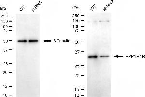 Western blotting analysis using PPP1R1B antibody (ABIN7800018). (Recombinant DARPP32 抗体)