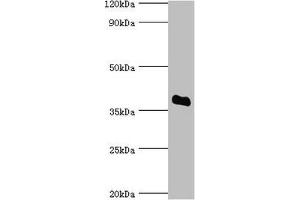 Western blot All lanes: Bile salt sulfotransferase antibody at 5 μg/mL + HepG2 whole cell lysate Secondary Goat polyclonal to rabbit IgG at 1/10000 dilution Predicted band size: 38 kDa Observed band size: 38 kDa (SULT2A1 抗体  (AA 1-145))