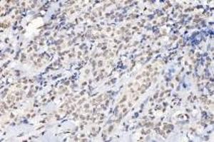 Immunohistochemistry (Paraffin-embedded Sections) (IHC (p)) image for anti-Ring Finger Protein 1 (RING1) antibody (ABIN7075467)