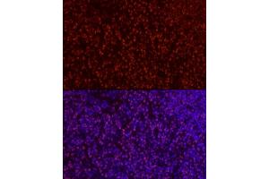 Immunofluorescence analysis of rat thymus cells using S Rabbit pAb (ABIN6130296, ABIN6147396, ABIN6147398 and ABIN6221485) at dilution of 1:50 (40x lens). (SATB1 抗体  (AA 484-763))