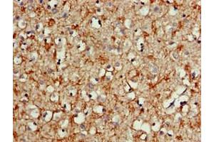 Immunohistochemistry of paraffin-embedded human brain tissue using  at dilution of 1:100 (ALK 抗体  (AA 1402-1604))