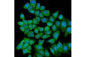 anti-Regulator of Chromosome Condensation 2 (RCC2) (AA 293-522) antibody