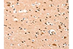 The image on the left is immunohistochemistry of paraffin-embedded Human brain tissue using ABIN7189955(BAZ1A Antibody) at dilution 1/25, on the right is treated with synthetic peptide. (BAZ1A 抗体)