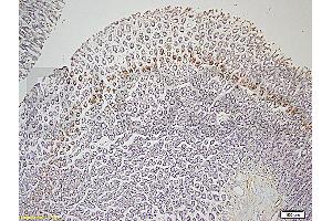 Formalin-fixed and paraffin embedded rat colon tissue labeled with Rabbit Anti-Leptin receptor(long) Polyclonal Antibody (ABIN725060) at 1:200 followed by conjugation to the secondary antibody and DAB staining. (Leptin Receptor 抗体  (AA 901-1000))