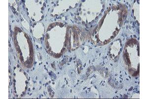 Image no. 1 for anti-Prefoldin Subunit 3 (PFDN3) antibody (ABIN1501700) (VBP1 抗体)