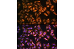 Immunofluorescence analysis of U2OS cells using SO Rabbit pAb (ABIN6129624, ABIN6148259, ABIN6148260 and ABIN6221917) at dilution of 1:100. (SOAT1 抗体  (AA 1-130))