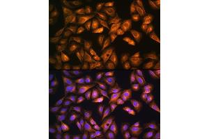 Immunofluorescence analysis of U2OS cells using SO Rabbit pAb (ABIN6129624, ABIN6148259, ABIN6148260 and ABIN6221917) at dilution of 1:100. (SOAT1 抗体  (AA 1-130))