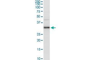 MAGEA9 MaxPab rabbit polyclonal antibody. (MAGEA9 抗体  (AA 1-315))