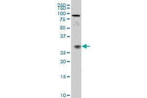 TGIF2 monoclonal antibody (M02), clone 5B11 Western Blot analysis of TGIF2 expression in IMR-32 . (TGIF2 抗体  (AA 131-236))
