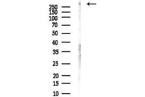 anti-ATR serine/threonine kinase (ATR) (pSer428) antibody