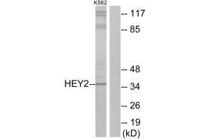 Western blot analysis of extracts from K562 cells, using HEY2 antibody.