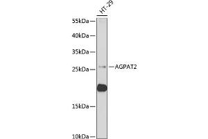 Western blot analysis of extracts of HT-29 cells, using  antibody (ABIN6129825, ABIN6136640, ABIN6136641 and ABIN6222174) at 1:1000 dilution. (AGPAT2 抗体  (AA 199-278))