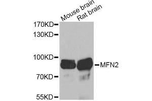 Western blot analysis of extracts of various cell lines, using MFN2 Antibody (ABIN6290636) at 1:1000 dilution. (MFN2 抗体)