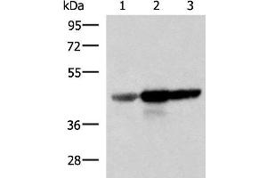 Western blot analysis of Human fetal brain tissue HepG2 and HT29 cell lysates using FDFT1 Polyclonal Antibody at dilution of 1:1000 (FDFT1 抗体)