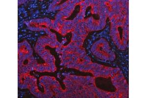 IF analysis of Cytokeratin 19 using anti-Cytokeratin 19 antibody (ABIN3043288). (Cytokeratin 19 抗体  (C-Term))